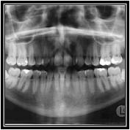 Dental-Imaging